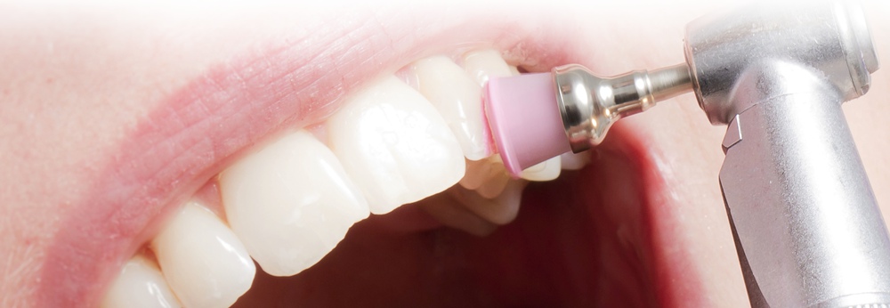 Wellness für Ihre Zähne - Präzises Arbeiten Hand in Hand